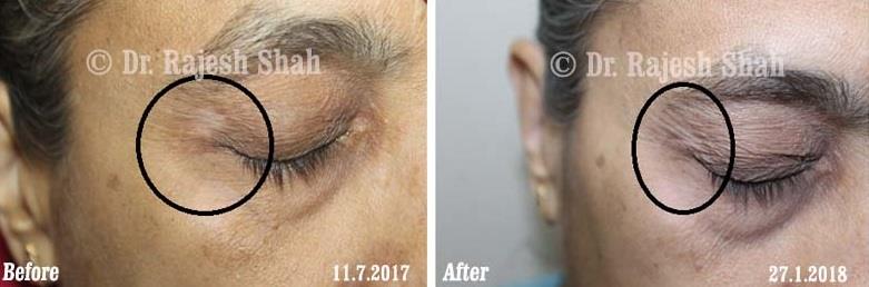 lifeforce homeopathy case-photos